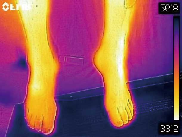 サーモグラフィ写真。足全体の皮膚温度が高い状態を保っている