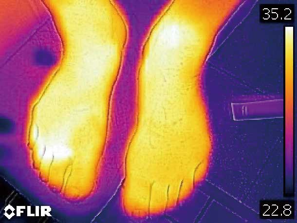 サーモグラフィ写真。足全体の皮膚温度が高い