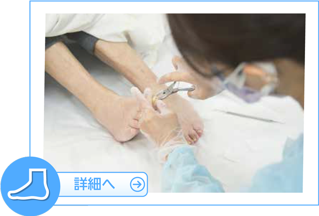 フットケア