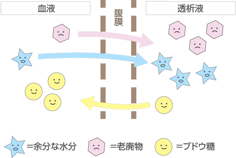 腹膜透析の仕組み